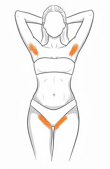 Náhľad: Bikiny normál + podpazušie