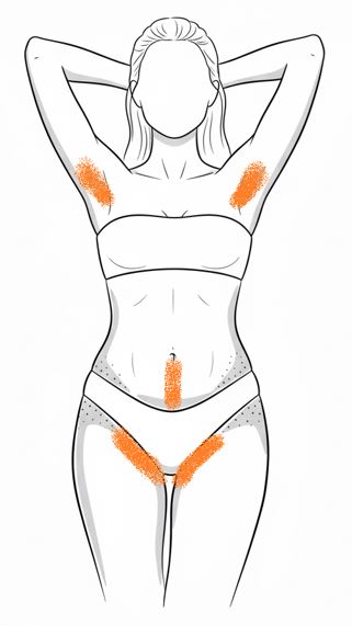 Náhľad: Bikiny normál + podpazušie + linea alba