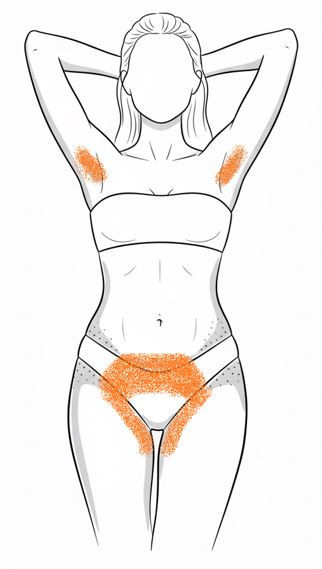 Náhľad: Bikiny zúžené + podpazušie